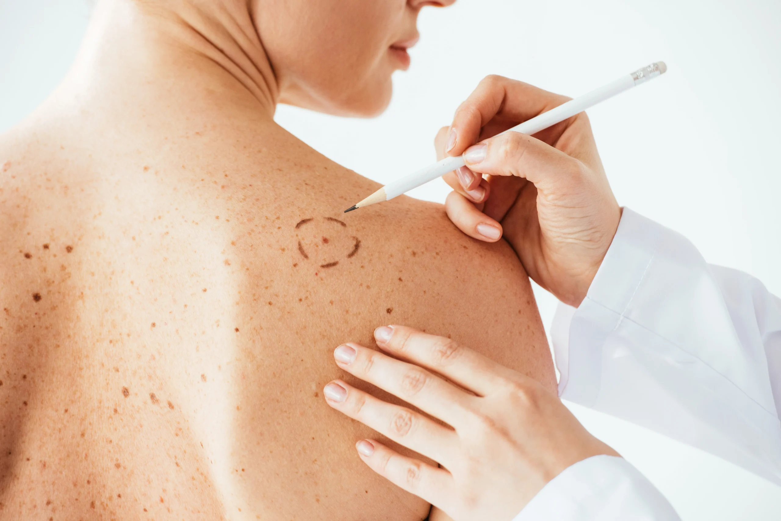 cropped-view-of-dermatologist-applying-marks-on-sk-2026-03-12-23-58-36-utc