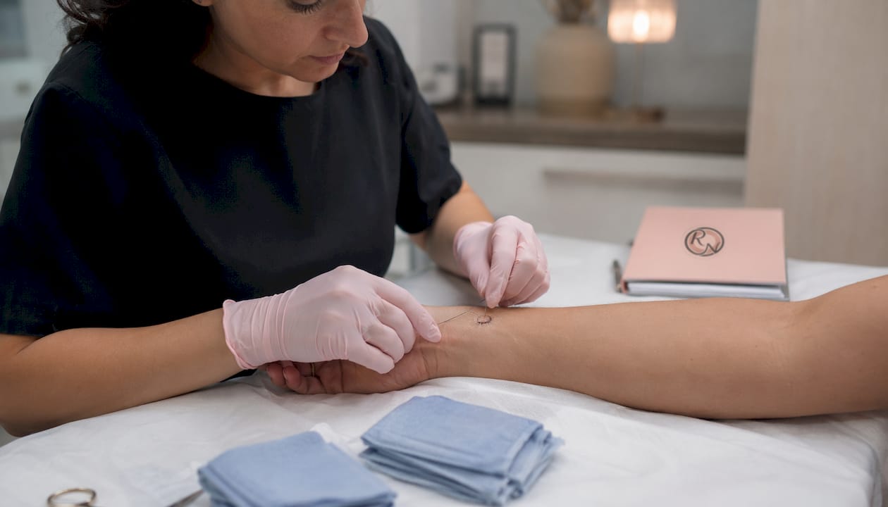 Clinician suturing skin biopsy wound